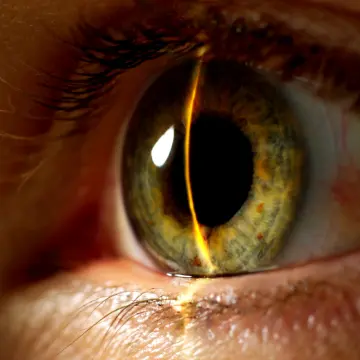 A close up of an eye with a light shining in the pupil